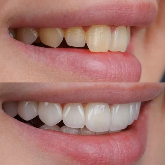 Blanqueador HiWhite™ + Cepillo de Bambú